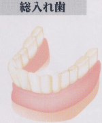 総入歯の問題点